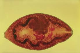 Paragonimus westermani